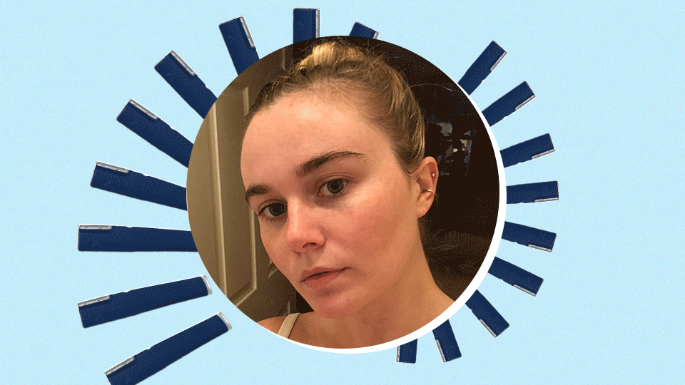 My Peach Fuzz Died a Quick, Painless Death With the DermaFlash and I’m Eternally Grateful—Shop It on Sale