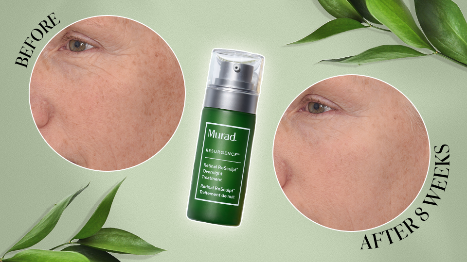 Murad’s Powerful New Retinal Serum Promises Firmer Skin Faster Than Ever — In 2-4 Weeks