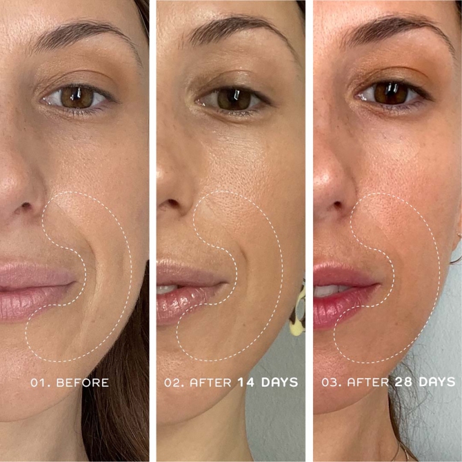 Sérum jeunesse bio-rétinoïde de Ren Skincare