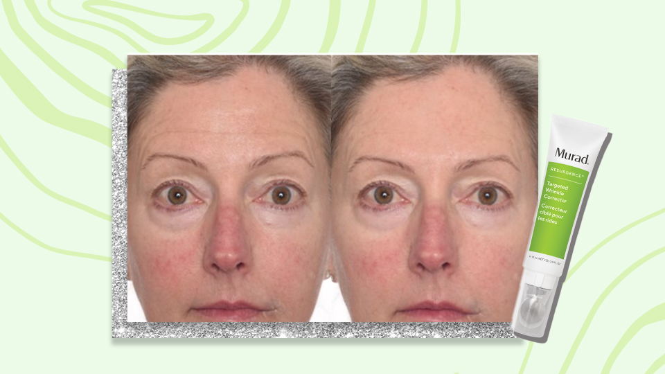 The Murad Wrinkle-Smoother That Mimics Botox Is on Major Discount