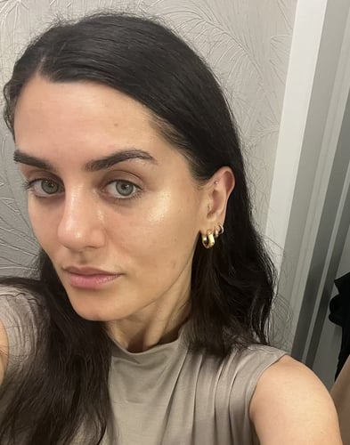 Ma peau avant d'utiliser le sérum à l'acide mandélique The Ordinary