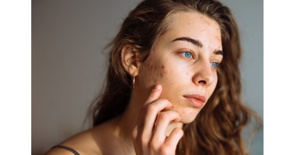 Votre bien-être mental peut-il affecter votre peau ?  Les experts disent oui