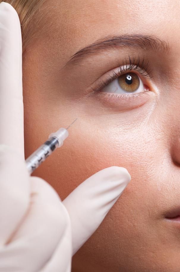 Comment éliminer les cercles sombres vasculaires