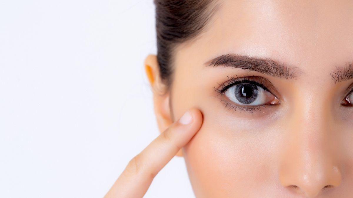 Ojeras vasculares: qué son y cómo tratarlas