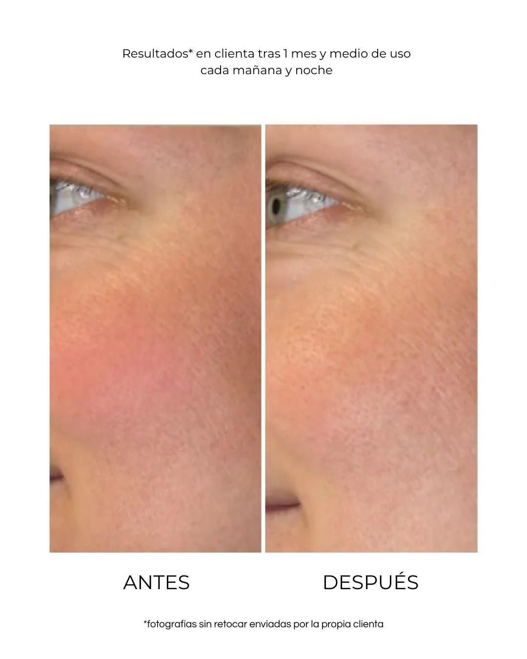 Sérum pour la peau sensible