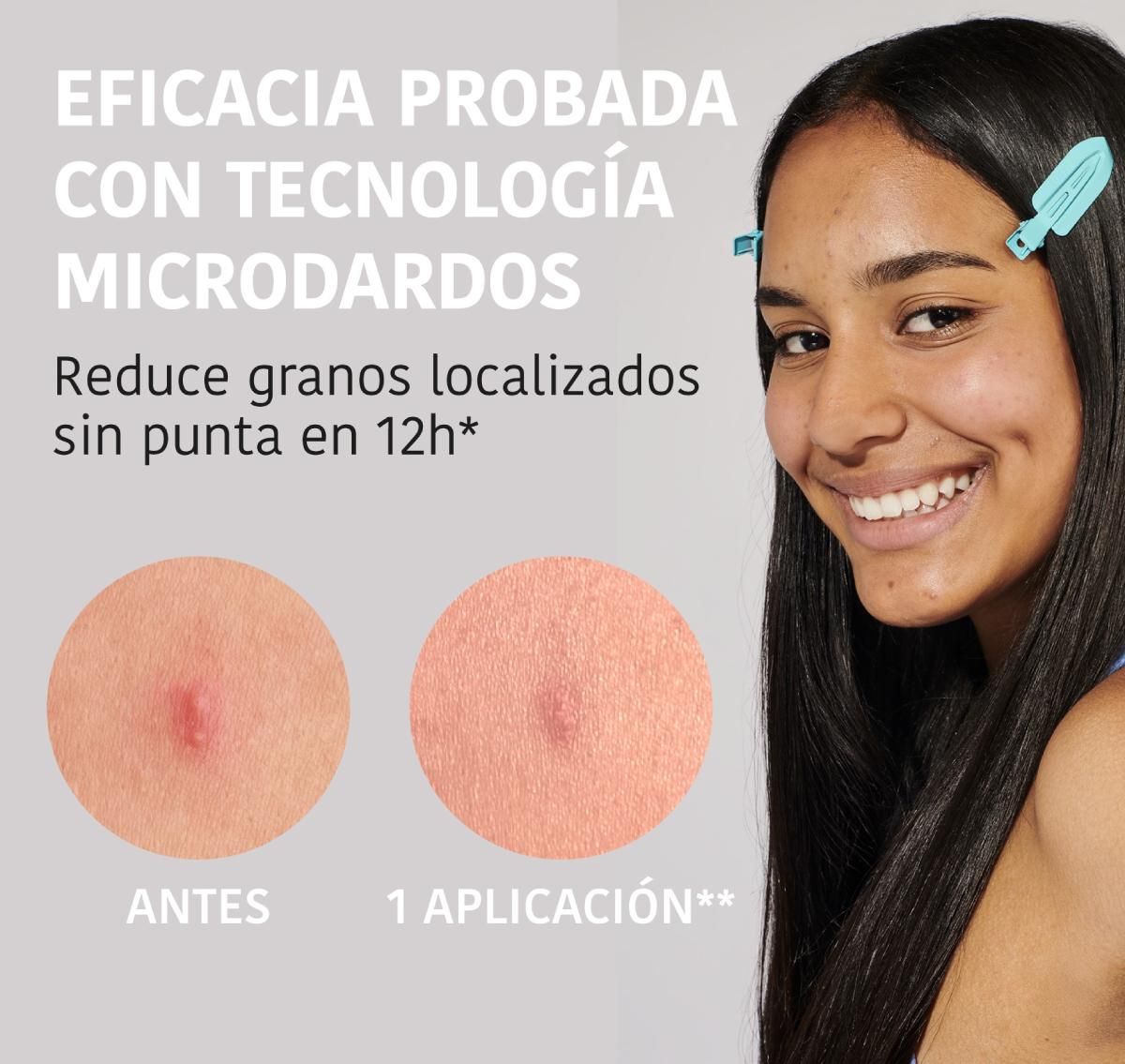 Les nouveaux patchs de grains avec les microdardos de la nature iroha