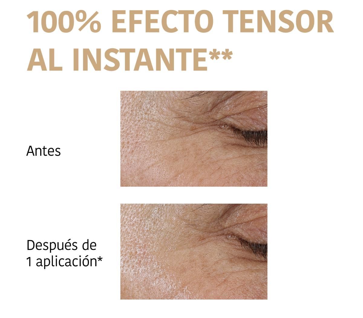 Les résultats des patchs Iroha Nature.