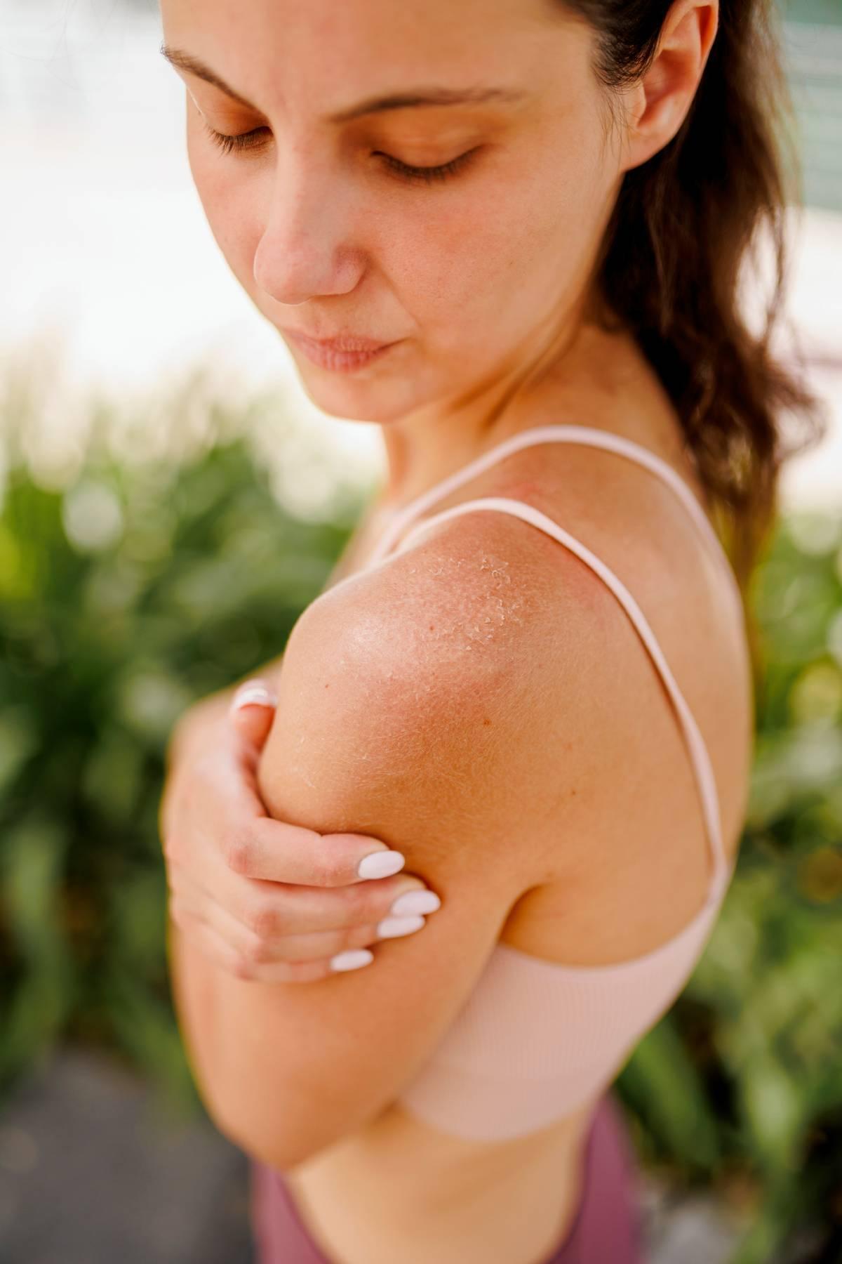 La climatisation, une des raisons pour lesquelles votre peau est sèche en été
