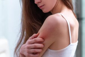Cristina Carvajal, ingénieur chimiste : « J'ai toujours eu des boutons sur les bras et la seule chose qui marche pour moi est d'exfolier avec de l'acide salicylique, en utilisant une crème à l'urée et au cicalfate »