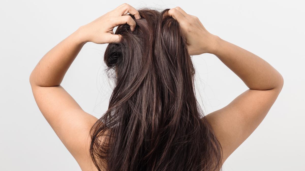 Los expertos hablan sobre la diferencia entre la caspa y la dermatitis seborreica