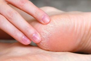 Roger Nebot, pharmacien : « Pour les pieds secs et les talons craquelés, une bonne habitude nocturne est d'appliquer une généreuse couche de crème et d'enfiler des chaussettes en coton. C'est simple et, pour lutter contre la sécheresse, c'est généralement bien plus efficace que de prolonger n'importe quel bain de pieds. »